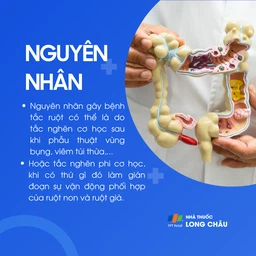 Tắc ruột 3