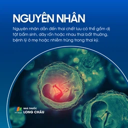 Thai chết lưu 3