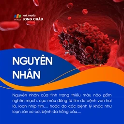 Thiếu máu não 3