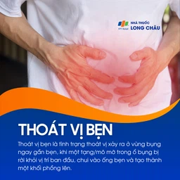 Thoát vị bẹn 1