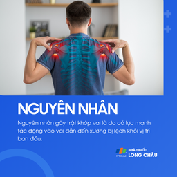 Trật khớp vai 3