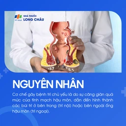 Bệnh trĩ 3