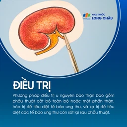 U nguyên bào thận 6