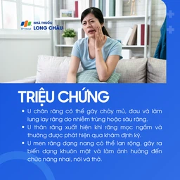 U răng 2