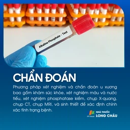 U xương 5