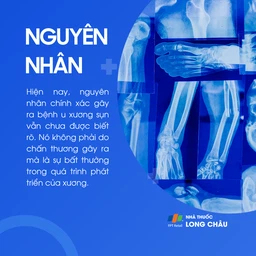 U xương sụn 3