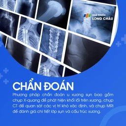 U xương sụn 5