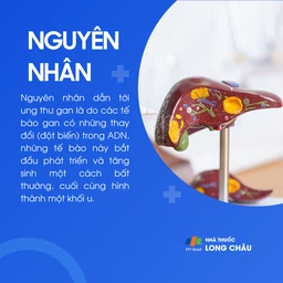 Ung thư gan 3