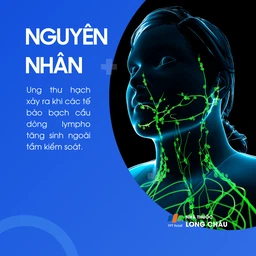 Ung thư hạch 3