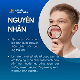 Ung thư lưỡi 3