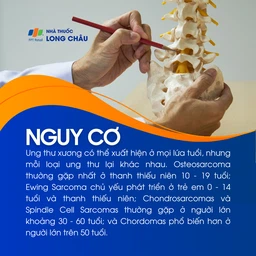 Ung thư xương 4