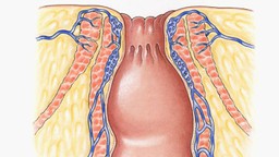 Viêm hậu môn là gì? Triệu chứng và cách phòng ngừa viêm hậu môn 1