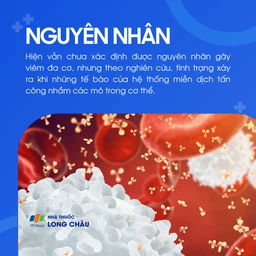 Viêm đa cơ 3
