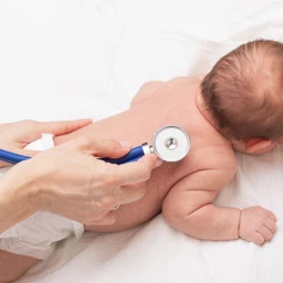 Viêm phổi RSV 1