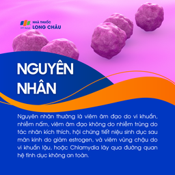 Viêm phụ khoa 3