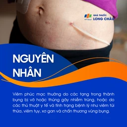 Viêm phúc mạc 3