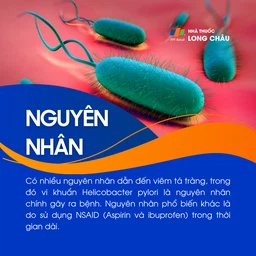Viêm tá tràng 3
