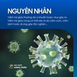 Viêm tai giữa 3