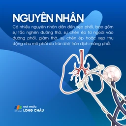 Xẹp phổi 3
