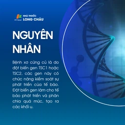 Xơ cứng củ 3
