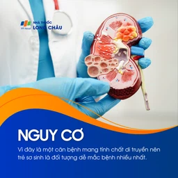 Xương thủy tinh 4