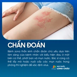 Zona thần kinh 5