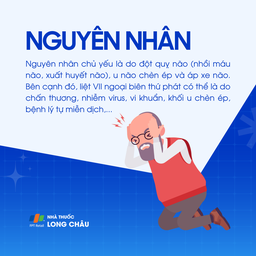 Liệt dây thần kinh số VII 3