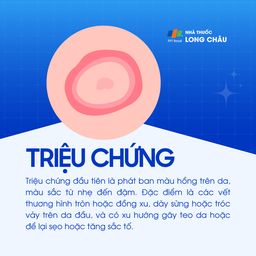 Lupus ban đỏ dạng đĩa 2
