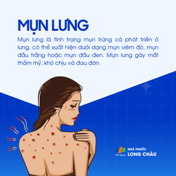 Mụn lưng 1