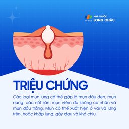 Mụn lưng 2