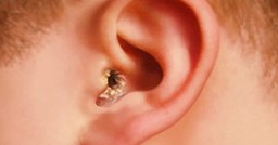 Nấm tai: Triệu chứng, nguyên nhân và cách điều trị