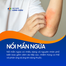 Nổi mẩn ngứa 1