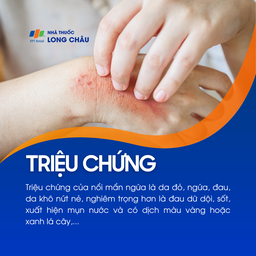 Nổi mẩn ngứa 2