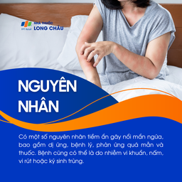 Nổi mẩn ngứa 3