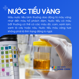 Nước tiểu vàng 1