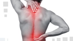 Rỗng tủy sống: Bệnh lý thần kinh hiếm gặp 2