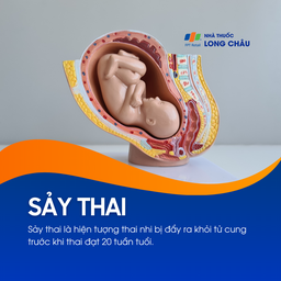 Sảy thai 1