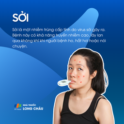 Bệnh sởi và đường lây truyền qua không khí