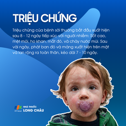 Triệu chứng bệnh sởi và thời gian ủ bệnh