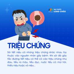 Sỏi niệu 2