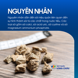 Sỏi niệu quản 3