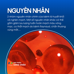 Tắc động mạch võng mạc trung tâm 3