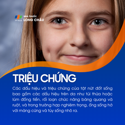 Tật nứt đốt sống 2