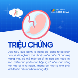 Thiếu một phần não 2