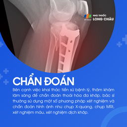 Thoái hóa đa khớp 5