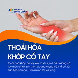 Thoái hóa khớp cổ tay 1