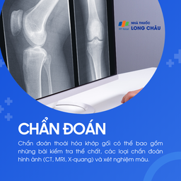 Thoái hóa khớp gối 5