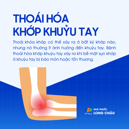 Thoái hóa khớp khuỷu tay 1