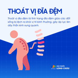 tình trạng đĩa đệm lệch khỏi vị trí bình thường gây áp lực lên dây thần kinh