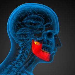 Tiêu xương hàm 1